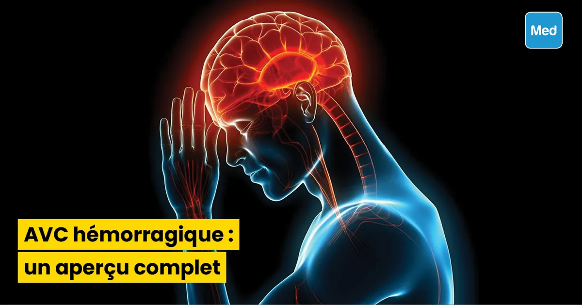 AVC hémorragique : un aperçu complet